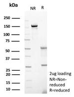 HK1/Hexokinase 1 Antibody in SDS-PAGE (SDS-PAGE)