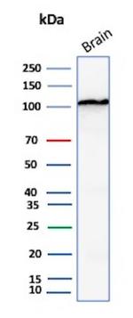 HK1/Hexokinase 1 Antibody in Western Blot (WB)