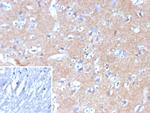 HK1/Hexokinase 1 Monoclonal Antibody (HK1/9517)