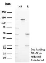 HK1/Hexokinase 1 Antibody in SDS-PAGE (SDS-PAGE)