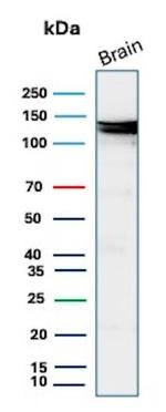 HK1/Hexokinase 1 Antibody in Western Blot (WB)