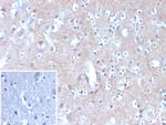 HK1/Hexokinase 1 Monoclonal Antibody (HK1/9506)