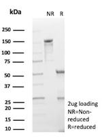 HK1/Hexokinase 1 Antibody in SDS-PAGE (SDS-PAGE)