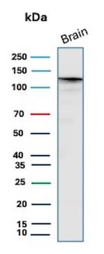 HK1/Hexokinase 1 Antibody in Western Blot (WB)