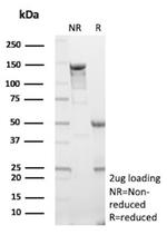 HK1/Hexokinase 1 Antibody in SDS-PAGE (SDS-PAGE)