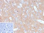 HK1/Hexokinase 1 Monoclonal Antibody (HK1/9509)