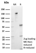 HK1/Hexokinase 1 Antibody in SDS-PAGE (SDS-PAGE)