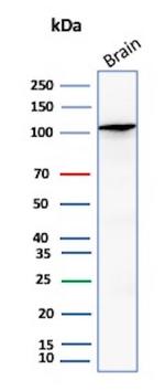 HK1/Hexokinase 1 Antibody in Western Blot (WB)