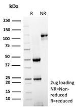 HK1/Hexokinase 1 Antibody in SDS-PAGE (SDS-PAGE)
