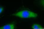 DDX60 Antibody in Immunocytochemistry (ICC/IF)