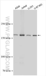 DDX60 Antibody in Western Blot (WB)