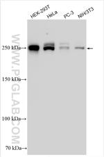 BAZ2A Antibody in Western Blot (WB)