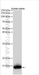 CST5 Antibody in Western Blot (WB)