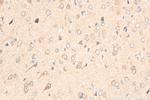 FPR2 Antibody in Immunohistochemistry (Paraffin) (IHC (P))
