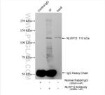 NLRP12 Antibody in Immunoprecipitation (IP)
