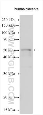 SHBG Antibody in Western Blot (WB)