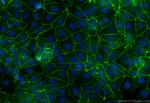 Nectin-4/PVRL4 Antibody in Immunocytochemistry (ICC/IF)