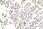Nectin-4/PVRL4 Antibody in Immunohistochemistry (Paraffin) (IHC (P))