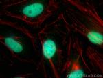 MLLT1 Antibody in Immunocytochemistry (ICC/IF)