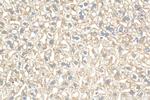 ADAMTS2 Antibody in Immunohistochemistry (Paraffin) (IHC (P))