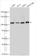 ADAMTS2 Antibody in Western Blot (WB)