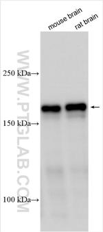 LRRC7 Antibody in Western Blot (WB)