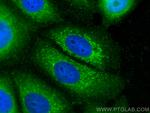 NRG1, isoform Alpha Antibody in Immunocytochemistry (ICC/IF)
