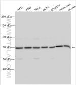 NRG1, isoform Alpha Antibody in Western Blot (WB)