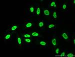 KHSRP Antibody in Immunocytochemistry (ICC/IF)