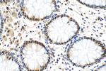KHSRP Antibody in Immunohistochemistry (Paraffin) (IHC (P))