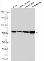 TRPV6 Antibody in Western Blot (WB)
