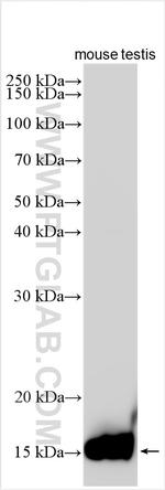 Histone H2B Antibody in Western Blot (WB)