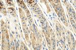 CLPX Antibody in Immunohistochemistry (Paraffin) (IHC (P))
