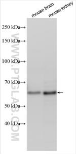 UTP18 Antibody in Western Blot (WB)