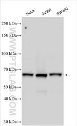 UTP18 Antibody in Western Blot (WB)