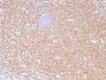 HLA-B (MHC Class I) Monoclonal Antibody (JOAN-1)