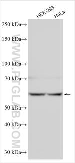 MTMR9 Antibody in Western Blot (WB)