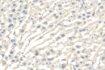SLC22A10 Antibody in Immunohistochemistry (Paraffin) (IHC (P))
