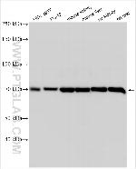 SLC22A10 Antibody in Western Blot (WB)
