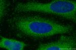 DNAH5 Antibody in Immunocytochemistry (ICC/IF)