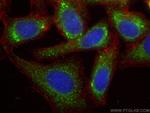 DNAH5 Antibody in Immunocytochemistry (ICC/IF)