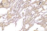 DNAH5 Antibody in Immunohistochemistry (Paraffin) (IHC (P))