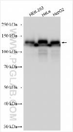 GOLIM4 Antibody in Western Blot (WB)