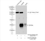 Cxcl15 Antibody in Immunoprecipitation (IP)