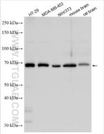 CORO1B Antibody in Western Blot (WB)