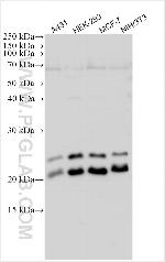 CBX1 Antibody in Western Blot (WB)