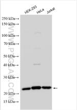 COMMD9 Antibody in Western Blot (WB)