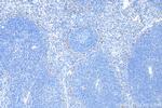 CD34 Antibody in Immunohistochemistry (Paraffin) (IHC (P))
