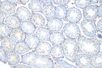 CD34 Antibody in Immunohistochemistry (Paraffin) (IHC (P))