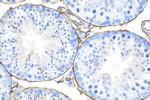 CD34 Antibody in Immunohistochemistry (Paraffin) (IHC (P))
